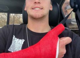 Sam Gaynor Injury/Recovery Update ** Warning: Graphic Images**